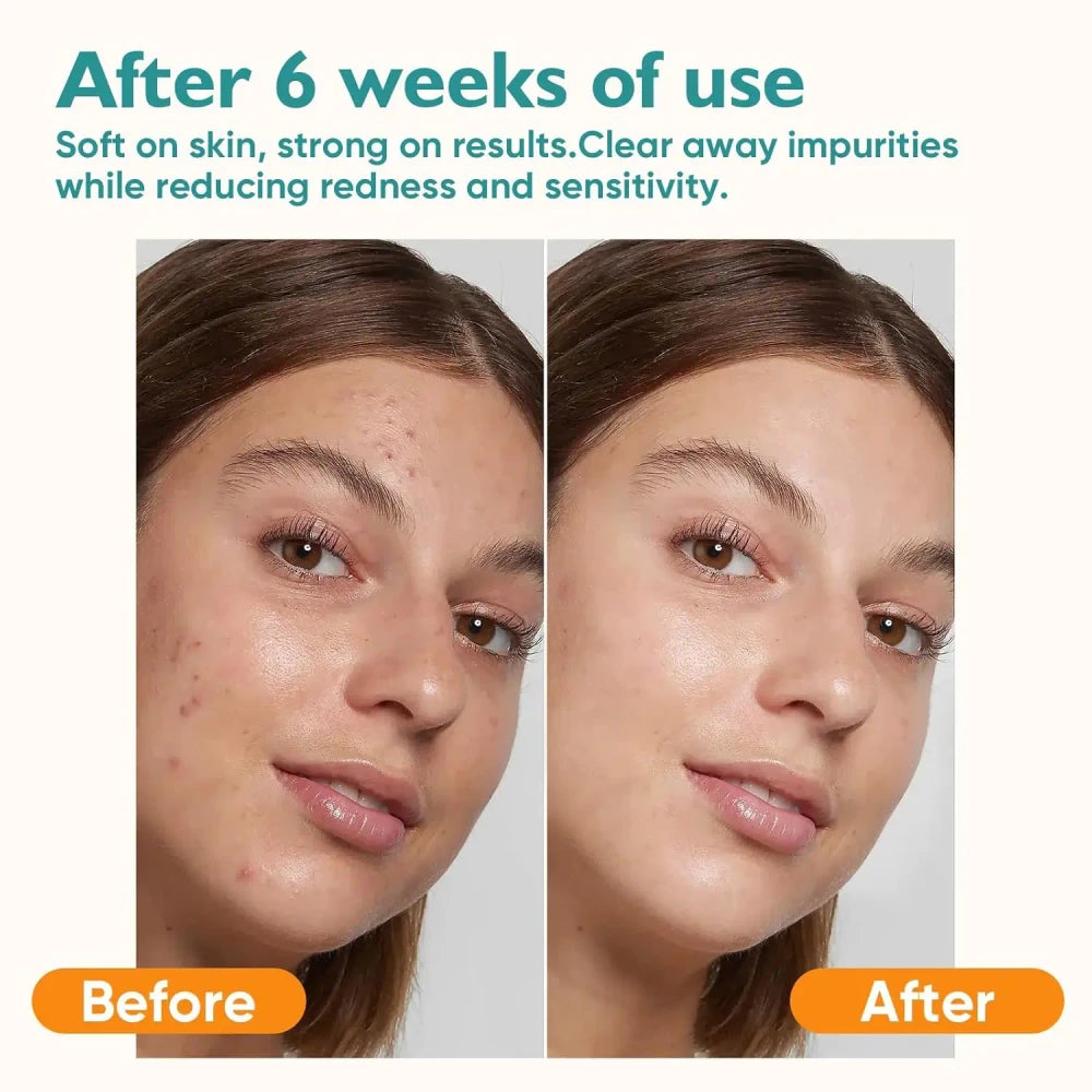 Ultra Soft Lint-Free Face Towels